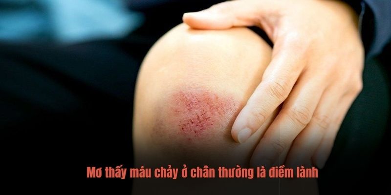 Mơ thấy máu chảy ở chân thường là điềm lành